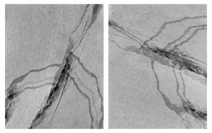 dannielle-bowman-untitled-diptych