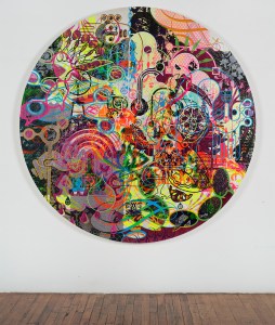 rm-hyperkulturemia-in-studio